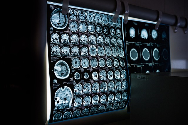 Politechnika Warszawska uruchamia centrum technologii medycznych HealthTEC