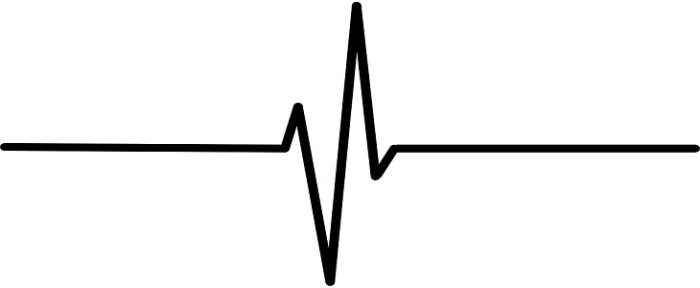 heartbeat730