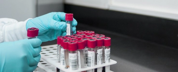 lab-blood-tests