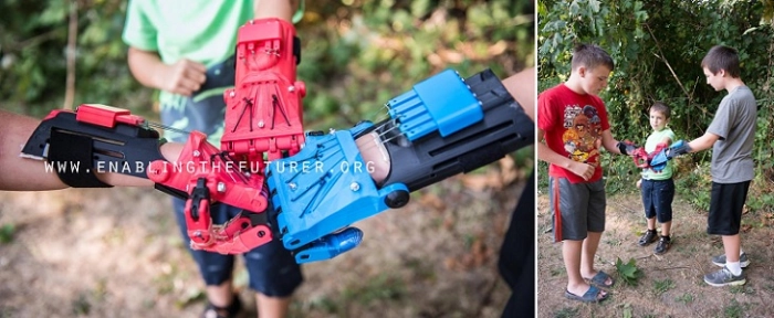 prosthesis
