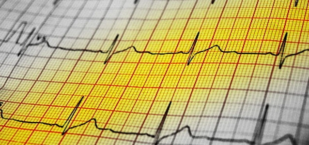ekg