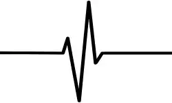 heartbeat730