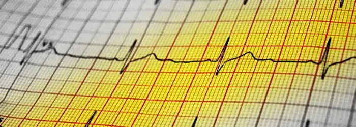 ekg
